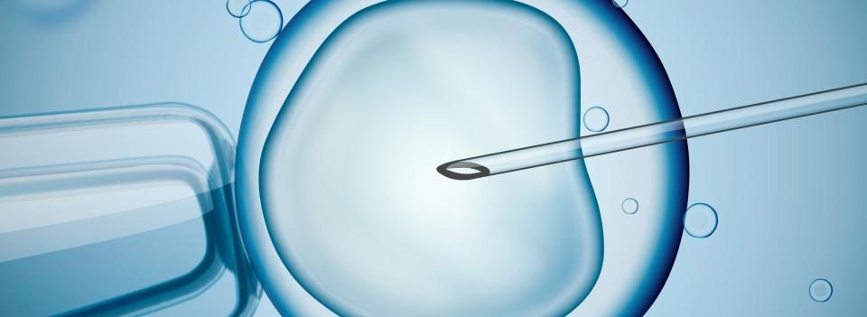 Künstliche Befruchtung