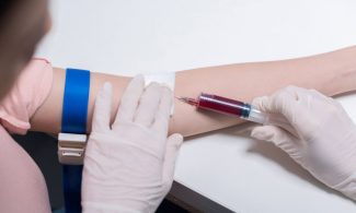 Downsyndrom-Bluttest wird unter bestimmten Voraussetzungen zur Kassenleistung