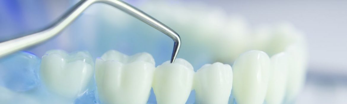 Steigende Versichertenzahlen bei der Zahnzusatzversicherung