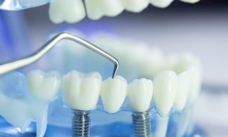 Steigende Versichertenzahlen bei der Zahnzusatzversicherung