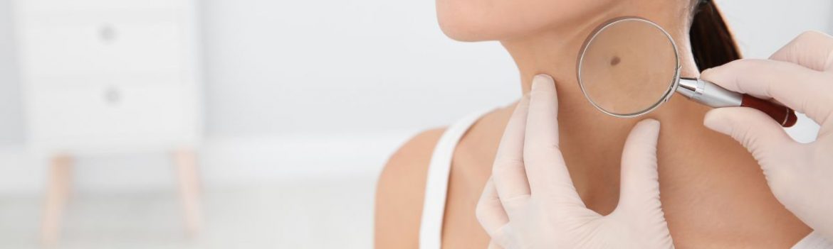 Vorsorge immer wichtiger: Zahl der Hautkrebsdiagnosen steigt