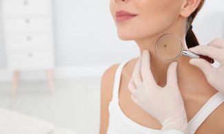 Vorsorge immer wichtiger: Zahl der Hautkrebsdiagnosen steigt