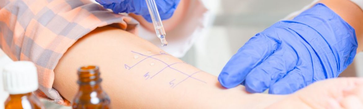 Nüsse, Eier, Milch: Warum immer mehr eine Lebensmittelallergie bekommen