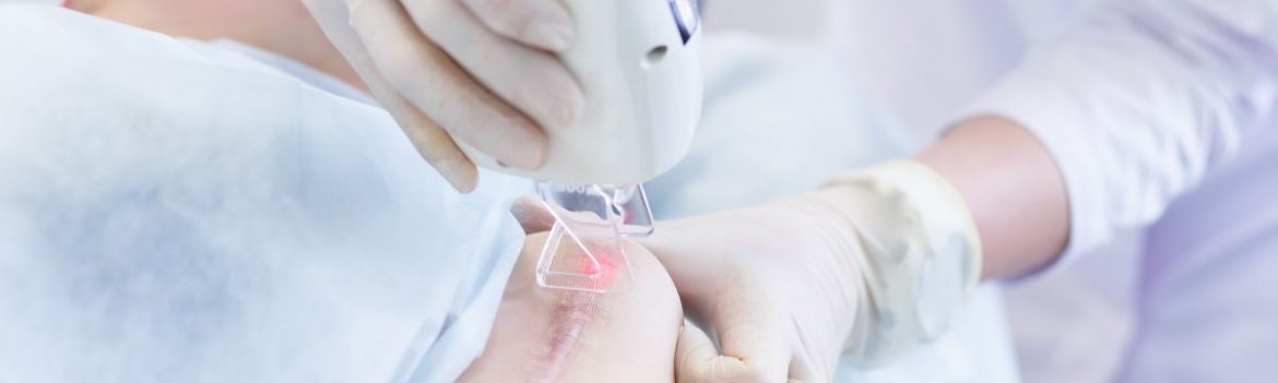 Narben loswerden – Behandlungsmöglichkeiten in der Übersicht